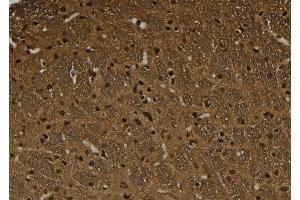 ABIN6274032 at 1/100 staining Rat brain tissue by IHC-P.