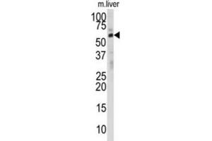 Western Blotting (WB) image for anti-24-Dehydrocholesterol Reductase (DHCR24) antibody (ABIN3001663) (Seladin 1 抗体)