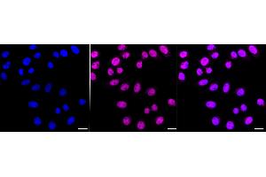 Immunocytochemical staining of HepG2 cells with Chromodomain helicase DNA binding protein 4 antibody (ABIN7800918), 1:1,000). (Recombinant Chromodomain Helicase DNA Binding 4 抗体)