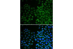 Immunofluorescence analysis of U2OS cells using NR0B2 antibody (ABIN5970937). (NR0B2 抗体)