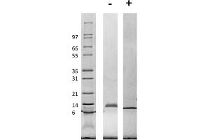 SDS-PAGE of Rat Macrophage Inflammatory Protein-1 alpha (CCL3) Recombinant Protein SDS-PAGE of Rat Macrophage Inflammatory Protein-1 alpha (CCL3) Recombinant Protein.