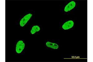 Immunofluorescence of monoclonal antibody to CDKL1 on HeLa cell. (CDKL1 抗体  (AA 259-358))