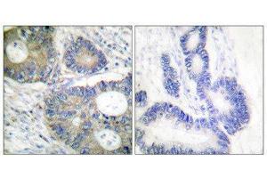 Immunohistochemistry (IHC) image for anti-Eukaryotic Translation Initiation Factor 4E Binding Protein 1 (EIF4EBP1) (Ser65) antibody (ABIN1847928) (eIF4EBP1 抗体  (Ser65))