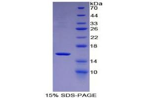 SDS-PAGE analysis of Mouse MBL2 Protein. (MBL2 蛋白)