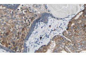 ABIN6269351 at 1/100 staining Human prostate tissue by IHC-P.