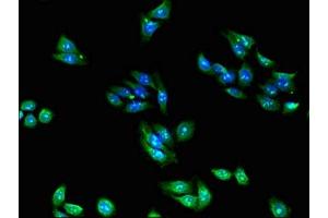 Immunofluorescent analysis of HepG2 cells using ABIN7142792 at dilution of 1:100 (RPL28 抗体  (AA 2-137))