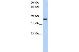WB Suggested Anti-HMG20B Antibody Titration:  0. (HMG20B 抗体  (Middle Region))