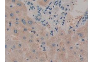 Immunohistochemistry (IHC) image for anti-Interleukin 12 alpha (IL12A) (AA 23-219) antibody (ABIN7428245)