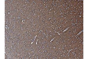 IHC analysis of NSF using anti-NSF antibody (ABIN7601630). (NSF 抗体  (AA 4-636))