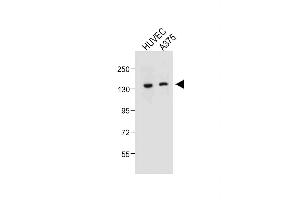 All lanes : Anti-TECPR1 Antibody (C-term) at 1:500 dilution Lane 1: HUVEC whole cell lysate Lane 2:  whole cell lysate Lysates/proteins at 20 μg per lane. (TECPR1 抗体  (C-Term))