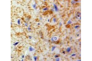 Used in DAB staining on fromalin fixed paraffin-embedded Brain tissue (CCL20 抗体  (AA 24-95))