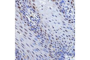 Immunohistochemistry of paraffin-embedded human esophageal using TP73 Rabbit pAb (ABIN6133470, ABIN6149430, ABIN6149431 and ABIN6213831) at dilution of 1:100 (40x lens). (Tumor Protein p73 抗体  (AA 1-100))