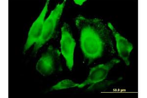 Immunofluorescence of purified MaxPab antibody to GGT1 on HeLa cell. (GGT1 抗体  (AA 1-569))