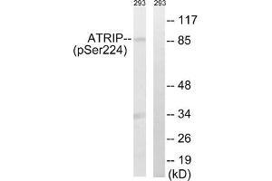 Western blot analysis of extracts from 292 cells, treated with UV (15 mins), using ATRIP (Phospho-Ser224) antibody. (ATRIP 抗体  (pSer224))