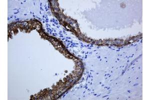 Image no. 1 for anti-Keratin 5 (KRT5) (AA 1-273) antibody (ABIN1490696) (Cytokeratin 5 抗体  (AA 1-273))