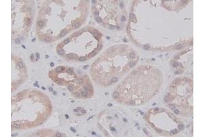 Immunohistochemistry (IHC) image for anti-Ras-related Protein Ral-A (rala) (AA 1-206) antibody (ABIN7428572)