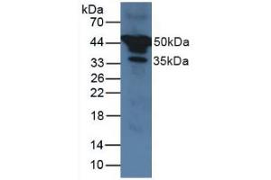Figure. (SERPINA1 抗体  (AA 25-418))