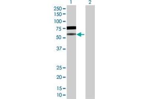 Western Blot analysis of BLNK expression in transfected 293T cell line by BLNK MaxPab polyclonal antibody. (B-Cell Linker 抗体  (AA 1-456))