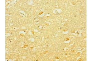 Immunohistochemistry of paraffin-embedded human brain tissue using ABIN7166564 at dilution of 1:100 (PCDH19 抗体  (AA 568-678))