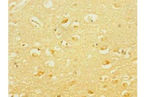 Immunohistochemistry of paraffin-embedded human brain tissue using ABIN7166564 at dilution of 1:100 (PCDH19 抗体  (AA 568-678))