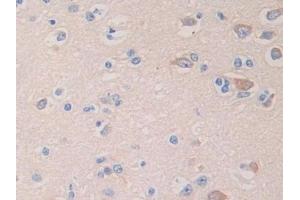Immunohistochemistry (IHC) image for anti-Glycine Dehydrogenase (GLDC) (AA 81-268) antibody (ABIN7438277)