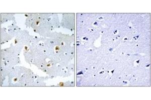 Immunohistochemistry analysis of paraffin-embedded human brain tissue, using FMN2 Antibody. (Formin 2 抗体  (AA 1541-1590))