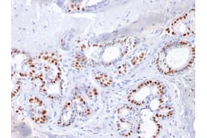 Immunohistochemistry (IHC) image for anti-Estrogen Receptor 1 (ESR1) antibody (ABIN6939339)