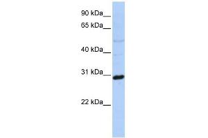 Metaxin 2 antibody used at 1 ug/ml to detect target protein. (MTX2 抗体  (N-Term))