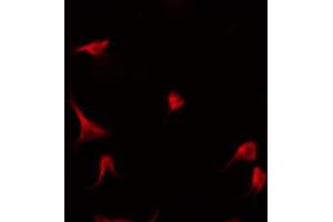 ABIN6266908 staining Hela by IF/ICC. (P18 INK 抗体)