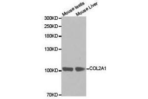 Western Blotting (WB) image for anti-Collagen, Type II, alpha 1 (COL2A1) antibody (ABIN1871948) (COL2A1 抗体)