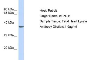 Host: Rabbit Target Name: KCNJ11 Sample Type: Fetal Heart lysates Antibody Dilution: 1. (KCNJ11 抗体  (Middle Region))