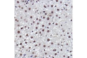 Immunohistochemistry of paraffin-embedded rat liver using MED4 Rabbit mAb (ABIN7268445) at dilution of 1:100 (40x lens). (MED4 抗体)