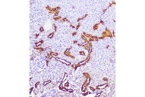 IHC analysis of Calbindin using anti-Calbindin antibody (ABIN6719541). (CALB1 抗体  (AA 2-261))