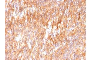 Immunohistochemistry (IHC) image for anti-Calnexin (CANX) (AA 1-300), (N-Term) antibody (ABIN6940952)