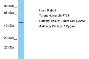 Host: Rabbit Target Name: ZNF736 Sample Type: Jurkat Whole Cell lysates Antibody Dilution: 1. (ZNF736 抗体  (N-Term))