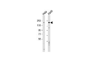 All lanes : Anti-IGF1R Antibody at 1:2000 dilution Lane 1: Hela whole cell lysate Lane 2: A549 whole cell lysate Lysates/proteins at 20 μg per lane. (IGF1R 抗体  (N-Term))