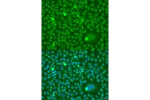 Immunofluorescence analysis of U2OS cells using CDK10 antibody (ABIN1871718) at dilution of 1:100. (CDK10 抗体)