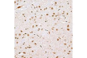 Immunohistochemistry of paraffin-embedded rat brain using CBX6 antibody (ABIN6127558, ABIN6138026, ABIN6138027 and ABIN6221185) at dilution of 1:100 (40x lens). (CBX6 抗体  (AA 80-180))