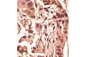 Image no. 1 for anti-Sirtuin 6 (SIRT6) (C-Term) antibody (ABIN358735)