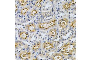Immunohistochemistry of paraffin-embedded mouse kidney using ADRBK1 Antibody (ABIN5970824) at dilution of 1/200 (40x lens). (GRK2 抗体)