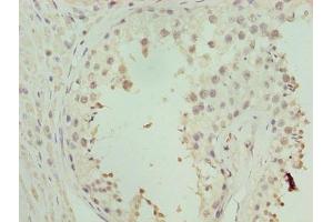 Immunohistochemistry of paraffin-embedded human testis tissue using ABIN7176343 at dilution of 1:100 (ZNF546 抗体  (AA 101-400))