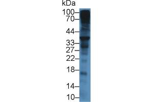 Western Blot; Sample: Mouse Liver lysate; Primary Ab: 12µg/mL Rabbit Anti-Mouse SDC1 Antibody Second Ab: 0. (Syndecan 1 抗体  (AA 23-255))