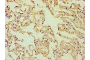 Immunohistochemistry of paraffin-embedded human lung tissue using ABIN7167766 at dilution of 1:100 (ALDH1A2 抗体  (AA 1-180))