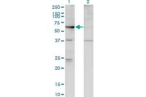 Western Blot analysis of ARHGEF5 expression in transfected 293T cell line by ARHGEF5 monoclonal antibody (M02), clone 4D10-D11. (ARHGEF5 抗体  (AA 1-519))