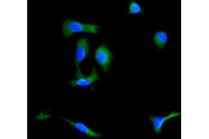 Immunocytochemistry analysis of Mouse MSC cells using Ly-6G Antibody. (Ly6g 抗体)