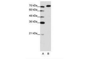 Image no. 3 for anti-A Kinase (PRKA) Anchor Protein 8-Like (AKAP8L) (C-Term) antibody (ABIN202849) (AKAP8L 抗体  (C-Term))