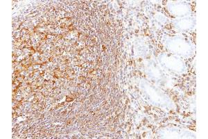 IHC-P Image Immunohistochemical analysis of paraffin-embedded human gastric N+T, using LBP, antibody at 1:100 dilution. (LBP 抗体)