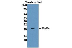 Western blot analysis of the recombinant protein. (PCCA 抗体  (AA 580-728))