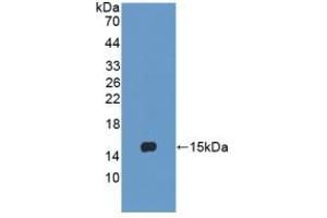 Detection of Recombinant LY96, Human using Polyclonal Antibody to Lymphocyte Antigen 96 (LY96) (LY96 抗体  (AA 19-130))