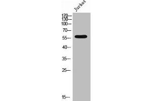 Western Blot analysis of JK cells using Phospho-4. (EPB41 抗体  (pTyr660))
